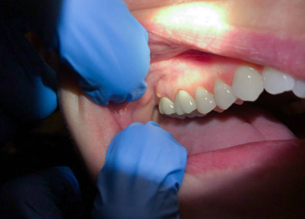 Best Walk-In Emergency Dental Services in Summerville, SC